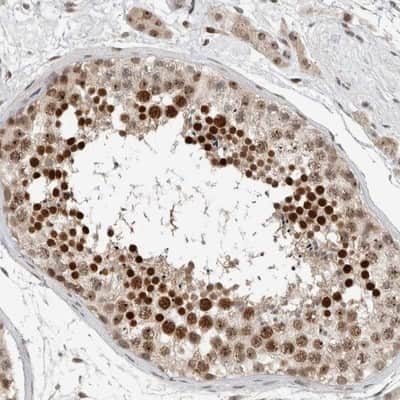 Immunohistochemistry-Paraffin: ZFP91 Antibody [NBP1-80863]