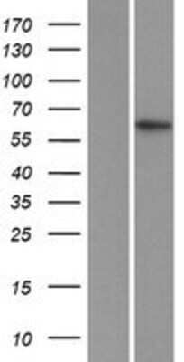 Western Blot: ZFP91 Overexpression Lysate [NBP2-05824]