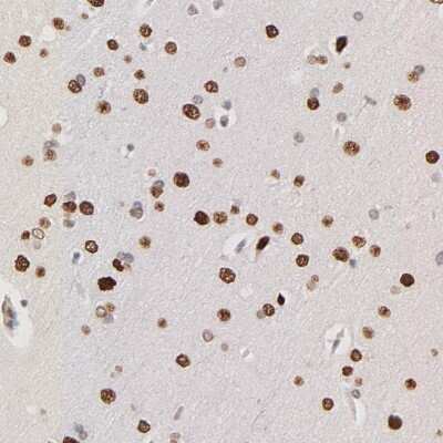 Immunohistochemistry: ZFP92 Antibody [NBP2-47573]