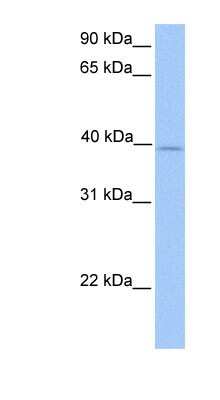 Western Blot: ZFP92 Antibody [NBP1-91394]