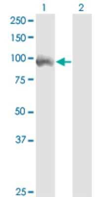 Western Blot: ZFP95 Antibody (1A7) [H00023660-M01]