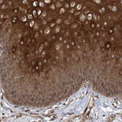 Immunohistochemistry-Paraffin: ZFP95 Antibody [NBP1-86834]