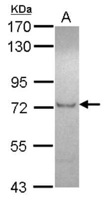 Western Blot: ZFP95 Antibody [NBP2-20947]