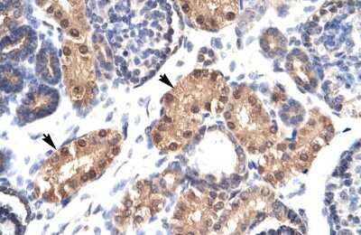 Immunohistochemistry: ZFPL1 Antibody [NBP2-86417]
