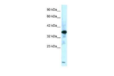 Western Blot: ZFPL1 Antibody [NBP2-86417]