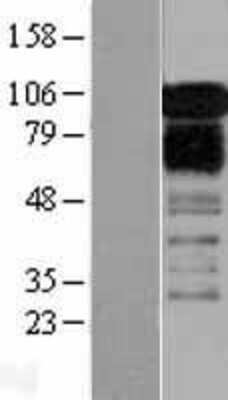 Western Blot: ZFPL1 Overexpression Lysate [NBP2-04319]