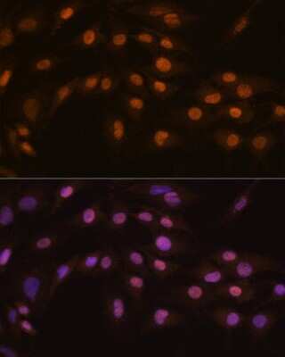 Immunocytochemistry/ Immunofluorescence: ZFPM1 Antibody - Azide and BSA Free [NBP3-05275]