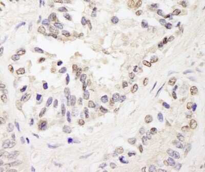 Immunohistochemistry-Paraffin: ZFPM1 Antibody [NB100-68241]