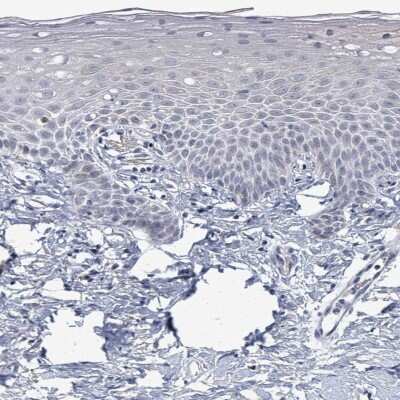 Immunohistochemistry-Paraffin: ZFPM1 Antibody [NBP2-47572]