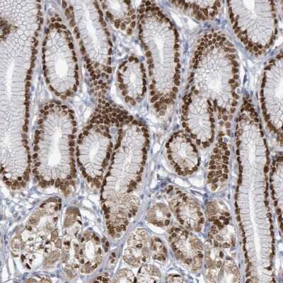 Immunohistochemistry-Paraffin: ZFPM1 Antibody [NBP2-47572]