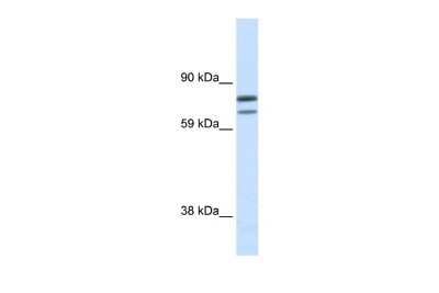 Western Blot: ZFPM1 Antibody [NBP2-88622]