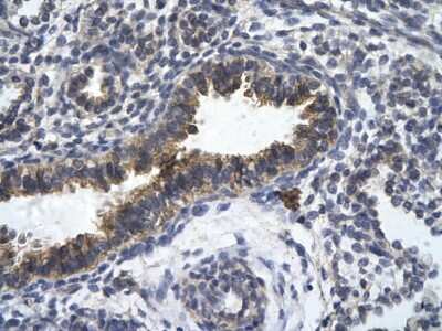 Immunohistochemistry-Paraffin: ZFR Antibody [NBP2-86419]