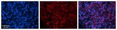 Immunohistochemistry-Paraffin: ZFR Antibody [NBP2-86419]