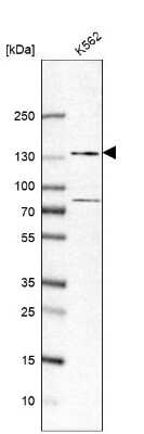 Western Blot: ZFR Antibody [NBP1-80601]