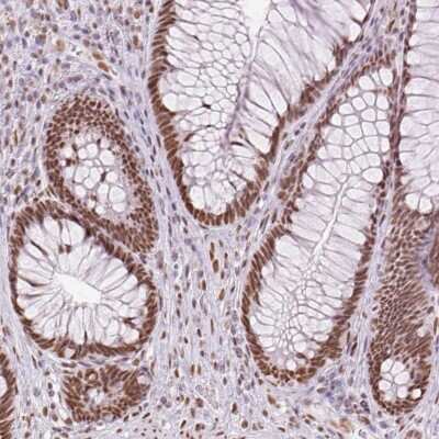 Immunohistochemistry: ZFR2 Antibody [NBP2-38766]