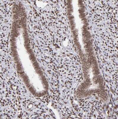 Immunohistochemistry-Paraffin: ZFX Antibody [NBP1-80582]