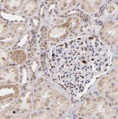 Immunohistochemistry-Paraffin: ZFX Antibody [NBP1-80582]