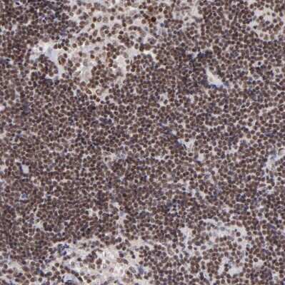 Immunohistochemistry-Paraffin: ZFX Antibody [NBP1-80582]