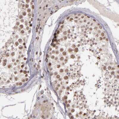 Immunohistochemistry-Paraffin: ZFX Antibody [NBP1-80583]