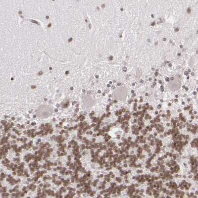 Immunohistochemistry-Paraffin: ZFX Antibody [NBP1-80583]