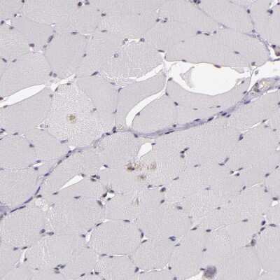 Immunohistochemistry-Paraffin: ZFX Antibody [NBP1-80583]