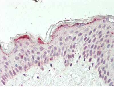 Immunohistochemistry-Paraffin: ZFX Antibody [NBP2-86421]