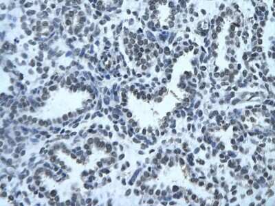 Immunohistochemistry-Paraffin: ZFX Antibody [NBP2-86421]