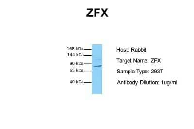 Western Blot: ZFX Antibody [NBP2-86421]