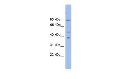 Western Blot: ZFX Antibody [NBP2-86422]
