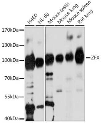 Western Blot: ZFX AntibodyAzide and BSA Free [NBP2-95185]