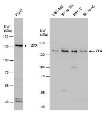 Western Blot: ZFX Antibody [NBP3-12949]