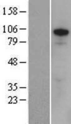 Western Blot: ZFX Overexpression Lysate [NBP2-08011]