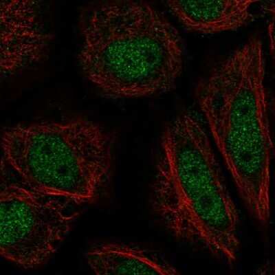 Immunocytochemistry/ Immunofluorescence: ZFY Antibody [NBP2-57923]