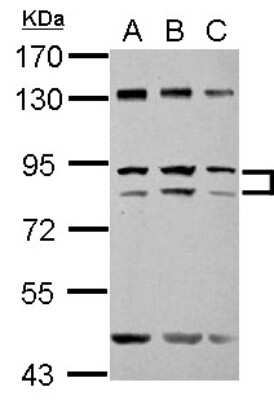 Western Blot: ZFY Antibody [NBP2-20949]