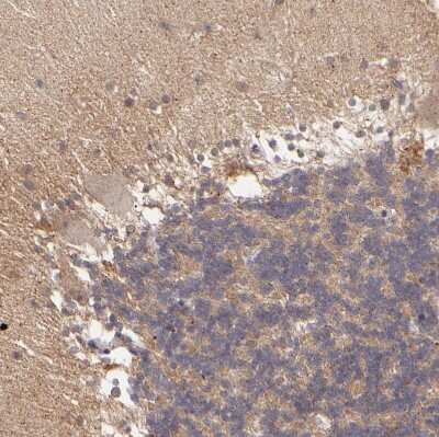 Immunohistochemistry-Paraffin: ZFYVE1 Antibody [NBP1-84267]