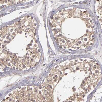 Immunohistochemistry-Paraffin: ZFYVE1 Antibody [NBP1-84267]