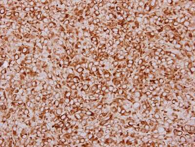 Immunohistochemistry-Paraffin: ZFYVE1 Antibody [NBP2-20950]
