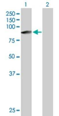 Western Blot: ZFYVE1 Antibody [H00053349-B01P]