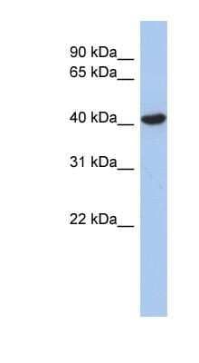 Western Blot: ZFYVE1 Antibody [NBP1-79426]