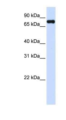 Western Blot: ZFYVE1 Antibody [NBP1-79427]