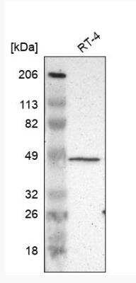 Western Blot: ZFYVE1 Antibody [NBP1-84267]