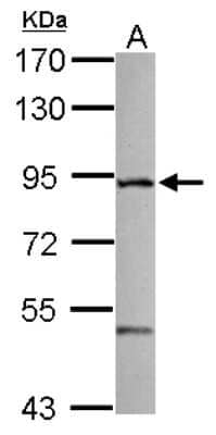 Western Blot: ZFYVE1 Antibody [NBP2-20950]