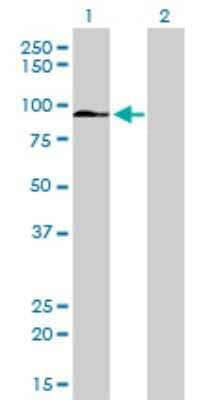 Western Blot: ZFYVE16 Antibody (4B9) [H00009765-M01]