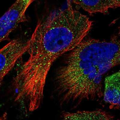 Immunocytochemistry/ Immunofluorescence: ZFYVE16 Antibody [NBP1-81517]