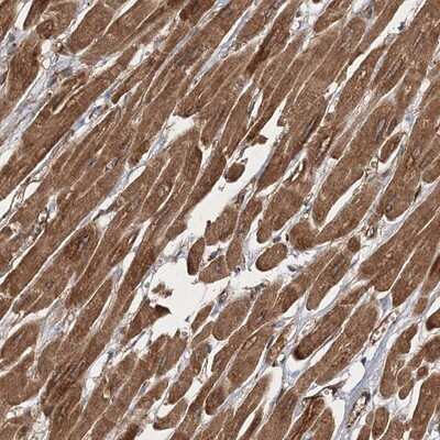 Immunohistochemistry-Paraffin: ZFYVE16 Antibody [NBP1-81517]
