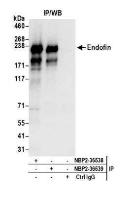 Immunoprecipitation: ZFYVE16 Antibody [NBP2-36538]