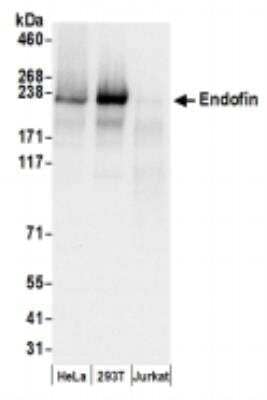 Western Blot: ZFYVE16 Antibody [NBP2-36538]