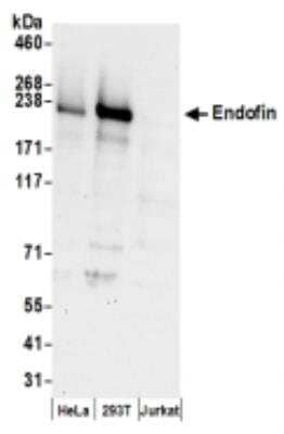 Western Blot: ZFYVE16 Antibody [NBP2-36539]