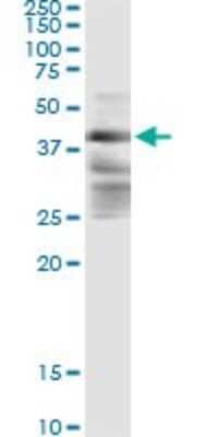 Immunoprecipitation: ZFYVE19 Antibody (3G4-2B11) [H00084936-M02]