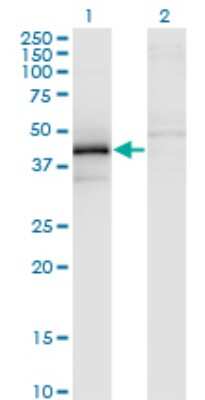 Western Blot: ZFYVE19 Antibody (3G4-2B11) [H00084936-M02]